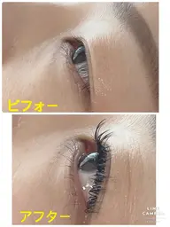 フラットラッシュ140本