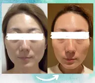 【話題のセルマン】🫧本格韓国ピーリングつや玉肌体験🫧 [兵庫県尼崎市/痩身エステ]