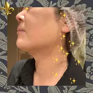 フェイスデザイン