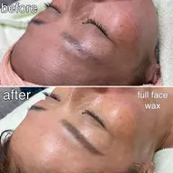 初回フェイシャルwax全額(眉は含まず)