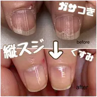 化学品を使わずネイルケアコース【自爪育成】【美爪ケア】