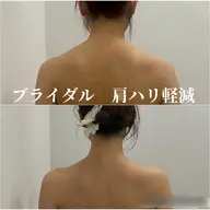 【都度ブライダル1DAY上半身集中コース】天使の羽×首肩ハリ×二の腕やせプラン90分でドレス映え★