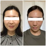 最強小顔60分(お着替え＋カウンセリング含)