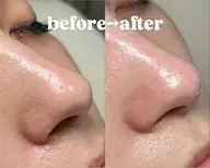 黒ずみとはさよなら👋黒ずみ撃退👃【🪄毛穴の黒ずみ・毛穴洗浄🪄】