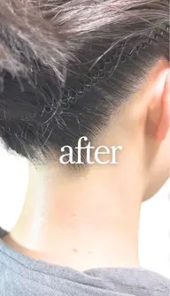 うなじの脱毛/デザイン剃毛付き/好みの後ろ姿に整えます