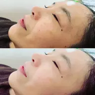 ハリアップ エステ