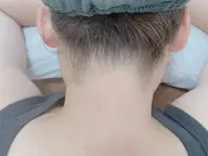 シュガーリング　うなじ