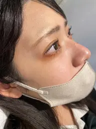 角栓毛穴洗浄+オーガニック☘️ワックス脱毛(小鼻、鼻下、鼻周り周辺+顎)10代​〜​20代前半限定☆施術は男性が担当します！