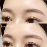 ハリウッドブロウリフト