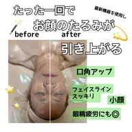 【美顔＋ボディ全身】150分46000→17000円！同時施術は何度でも特別価格🌟