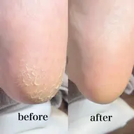 フットケア[フットバス・フットシャンプー付]