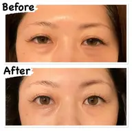 【クマ・シワ・たるみ】SP目元ケアコース💆🏼♀️