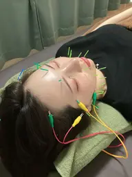 《美容鍼+整体》選べる施術つき120分コース