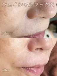 フェイシャルワックス