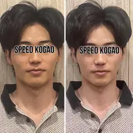 【メンズ限定】小顔矯正×毛穴洗浄🫧顎細Vライン✨保湿ピーリング垢抜け《顔痩せ/浮腫み/ザラつき/ニキビ/肌荒れ/乾燥》