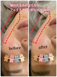 小顔フェイシャルマッサージ♪ 凝り固まった筋肉を緩め元の位置に戻す事で、シワやたるみの改善、リフトアップで小顔効果も！