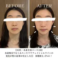 【平日16時まで限定】1番人気コース！水素まみれコース♪100分