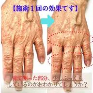 💫奇跡のハンドトリートメント💫エイジングケアハンドエステ/スタンダードコース