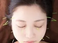 美容鍼＋身体のメンテナンス６０分