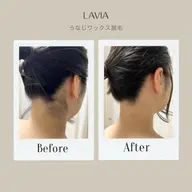 うなじワックス脱毛