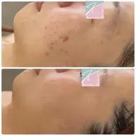 タラソトリートメント👳♀️✨