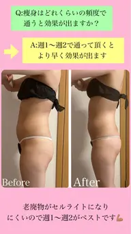 【産後👶🏻部分痩身】産後で何しても痩せにくくなった方❗️今からでも体質改善できますよ🙆‍♀️４／２９日​〜​再開します