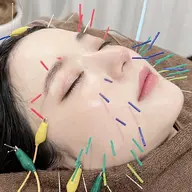 ⚠️平日限定[🏅女性に人気]🌈全身美容鍼(うつ伏せ&仰向け)＋パルス(電気鍼)＋マッサージ　90分