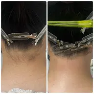 つるつるうなじWAX★