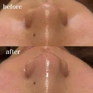 つい触りたくなる👀艶モチ肌💧毛穴洗浄+フェイシャルワックス🪞口コミ価格👀