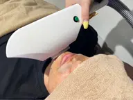 【ヒゲ剃り面倒な方！】全顔脱毛メンズ初回￥3,850