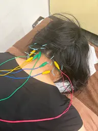【鍼｜眼精疲労・頭痛ケア】目の疲れや頭の重さに特化した鍼。こり固まった筋肉と血流を整え、スッキリ軽い頭へ導きます