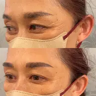 眉毛タトゥーリタッチ.眉毛タトゥー 2回目