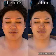 【リピーター様✨】本格的！本場韓国式🇰🇷韓国アイドル必須項目✅小顔筋膜リリースコルギコース💆🏻‍♀️💕