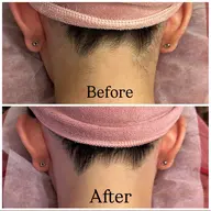 【2位🥈背中・うなじ脱毛✨¥11000→¥8000】(シェービング/角質ケア/保湿付)ご新規様限定🪽 回数:1回