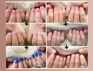 噛み癖から踏み出そう！[爪先のコンプレックスから脱却応援！深爪対策]噛み癖、イジり癖の方専用！深爪対策についての返信必須