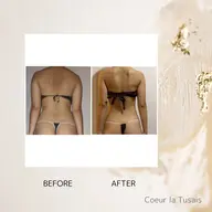 肩甲骨・肩こり集中コース