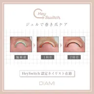 【歩くのが劇的ラクに！】巻き爪改善ケア☆ヘイスイッチ初回親指2本矯正（10本ケア ＋ 角質ケア込）