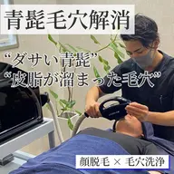 【メンズ脱毛】小鼻の皮脂ごっそり毛穴洗浄×顔脱毛で青髭レス韓国肌★