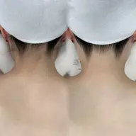 【 うなじ脱毛+シェービング 】後ろ姿美人へ🦢🏹