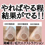 お客様で選べるmenu【小鼻の最強毛穴洗浄‼️】➕【お顔ピーリング】➕【美容液導入】美容液によりお値段変わります💆