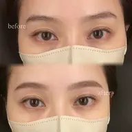 美肌メニュー💖アイブロウWax＋額鼻ワックス🤍ミニモ限定価格🩰(間引き・仕上げメイク込み)