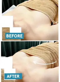 ⛄️バストアップBBL🍂ルミクスA9X