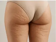 【オーダーメイド痩身】深部加温高周波&Wキャビ×EMS&リンパ上半身or下半身60分