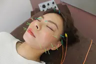 リフトアップ効果抜群◎ 【パルス美容鍼】 30分　￥7,000→￥4,000