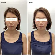 【🌷初回限定🌷】小顔矯正+ドライヘッドスパ(30分)