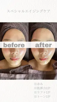 🌸1番人気 🌸スペシャル　エイジングケア(デコルテリンパ込み)✨