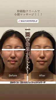 小顔フェイシャルマッサージ