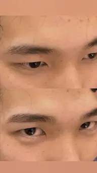 メンズ限定💫ワックス脱毛