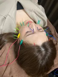 💛人気No.2💛電気美容鍼&リンパマッサージ エラはりさん、食いしばりや眼精疲労に☺️