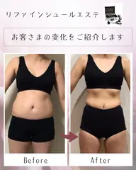 🌈女性限定🌈 気になるお腹まわりを集中的にケア✨